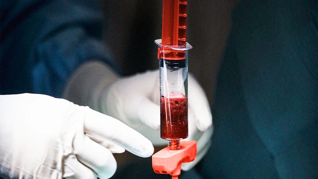 نبردی در اعماقِ مغز