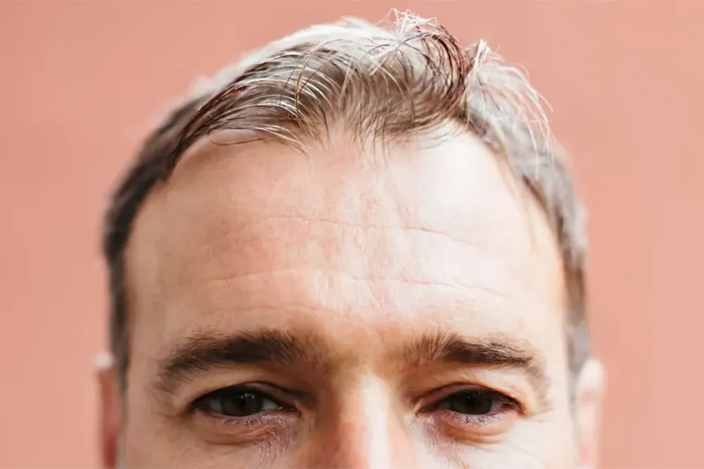 تاثیرات مخرب مواد مخدر بر سلامت پوست و مو: ورای زیبایی، خطری برای سلامتی